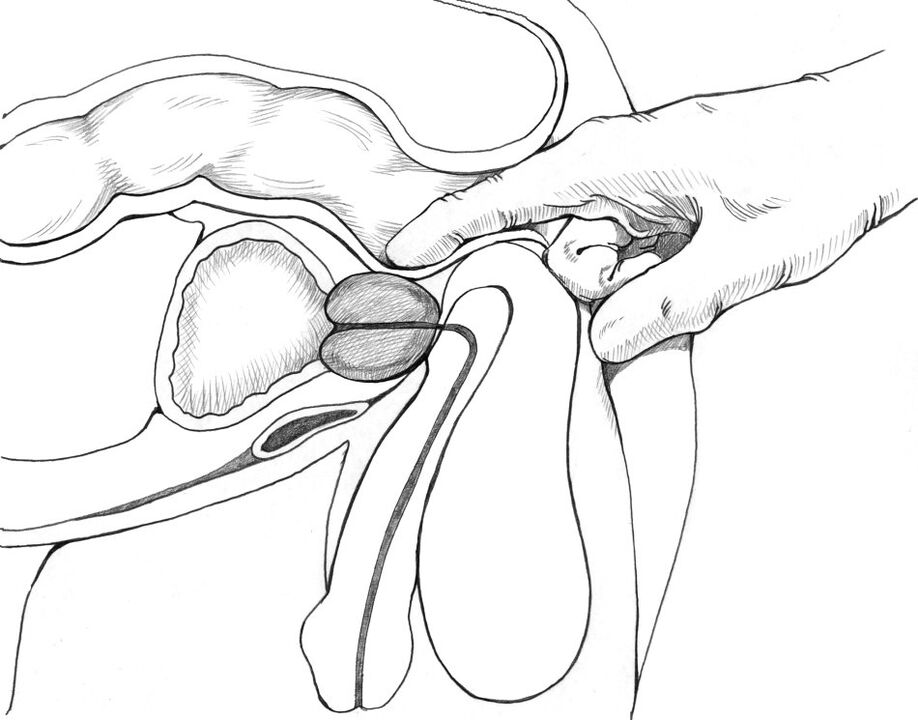 Le massage de la prostate fait partie de l'ensemble des méthodes de traitement de la prostatite.